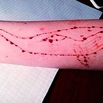 Συναγερμός για το διαδικτυακό παιχνίδι «Μπλε φάλαινες»