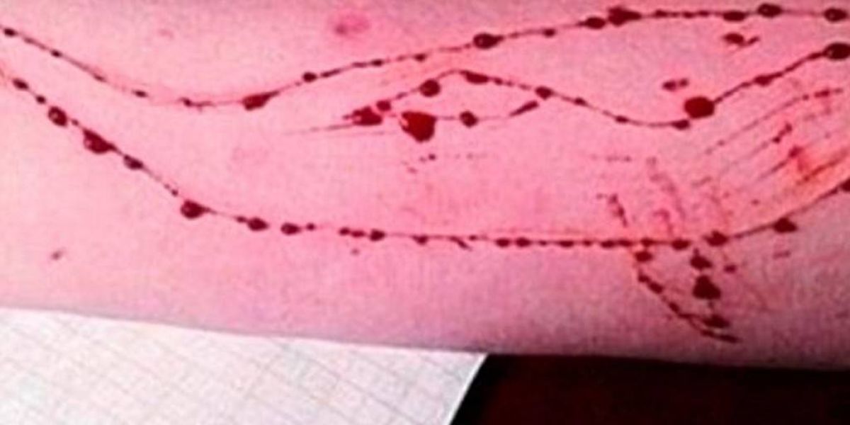 Συναγερμός για το διαδικτυακό παιχνίδι «Μπλε φάλαινες»