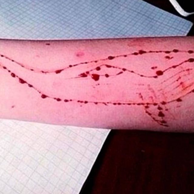 Συναγερμός για το διαδικτυακό παιχνίδι «Μπλε φάλαινες»