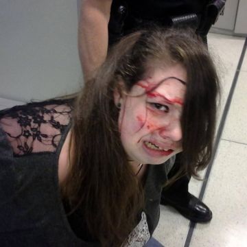 Σεκιούριτι αεροδρομίου θεώρησαν… ύποπτη 18χρονη ανάπηρη και καρκινοπαθή και την χτύπησαν άγρια